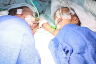 Die beiden Zwillinge Lydia und Maya nach ihrer Trennung im Berner Krankenhaus.
