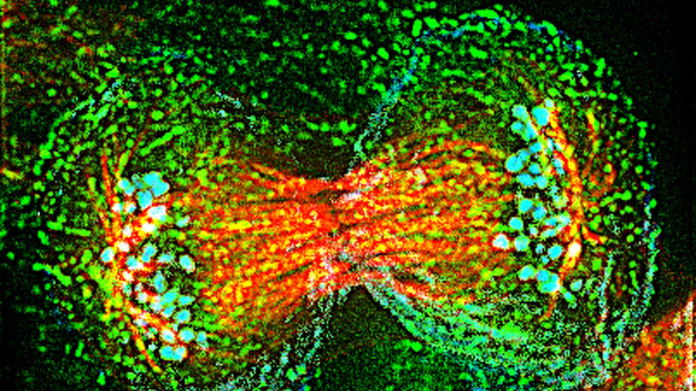 Die Krebszellen der Henrietta Lacks, auch "HeLa-Zellen" genannt, werden bis heute in der Forschung verwendet. So sehen sie unter dem Mikroskop aus.