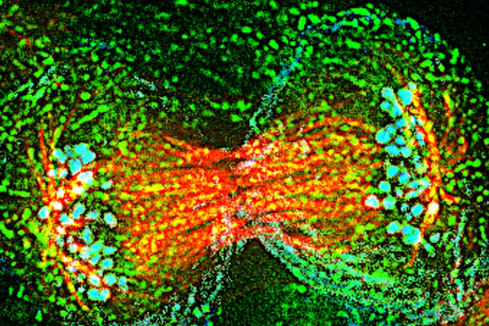 Die Krebszellen der Henrietta Lacks, auch "HeLa-Zellen" genannt, werden bis heute in der Forschung verwendet. So sehen sie unter dem Mikroskop aus.