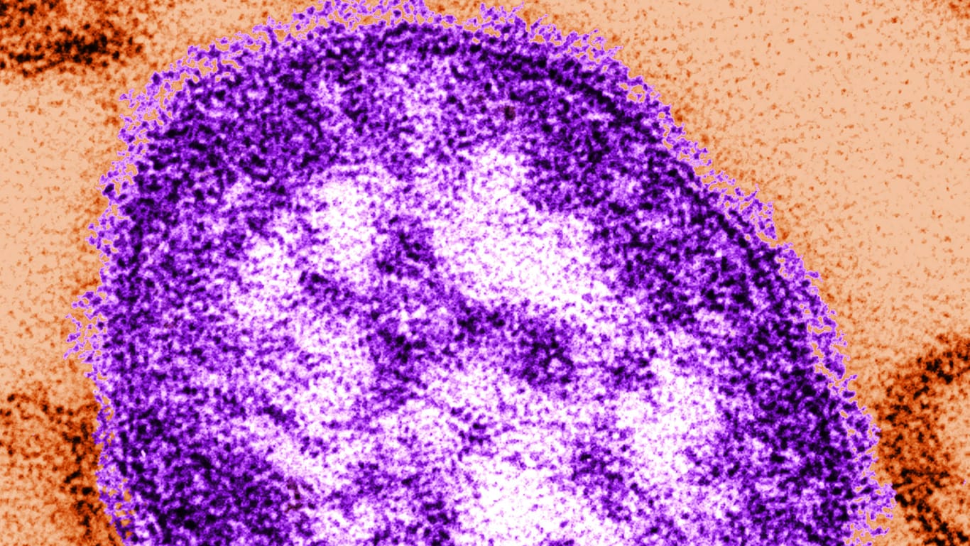 So sieht das Masern-Virus unter dem Elektronenmikroskop aus.