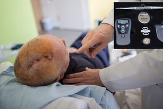 Parkinson: Hirnforscher Alfons Schnitzler untersucht einen Parkinson Patienten, dem ein Hirnschrittmacher eingesetzt wurde.