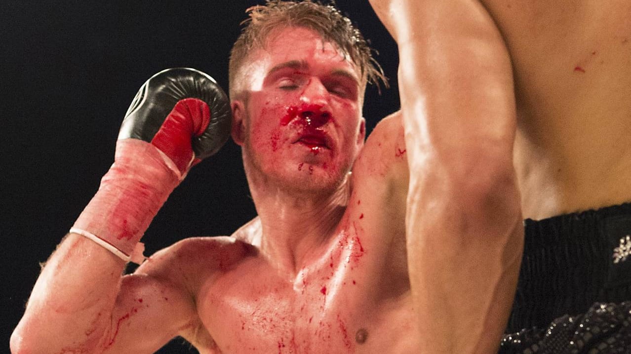 Nick Blackwell musste jede Menge Kopftreffer einstecken.