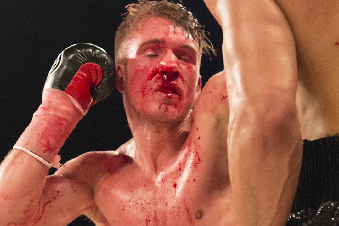 Nick Blackwell musste jede Menge Kopftreffer einstecken.