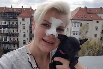 Aua-Foto auf Facebook: Melanie Müller hat die Nase wund.