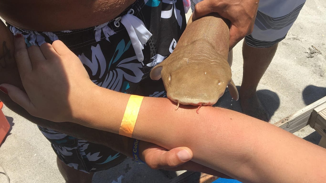 Ein Hai hat sich im Arm einer Frau verbissen.