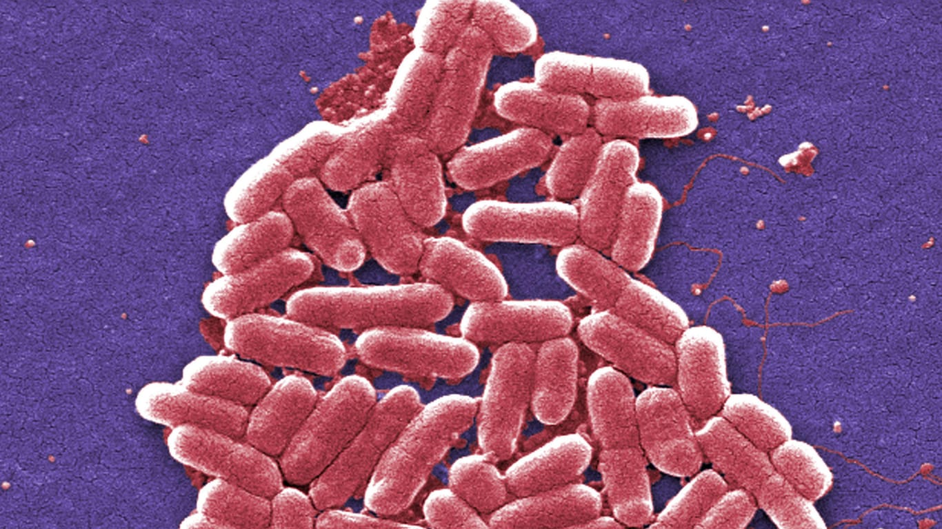 Gefährliche resistente Bakterien verbreiten sich immer mehr.