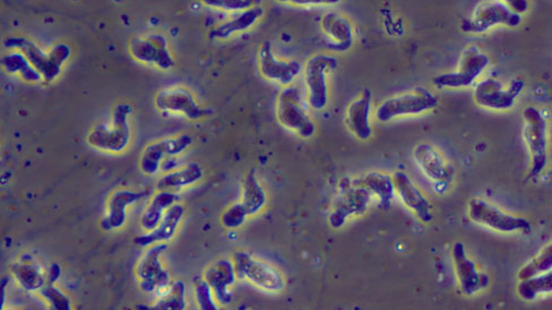 "Naegleria fowleri" unter dem Mikroskop: Die Amöben dringen ins Gehirn ein.