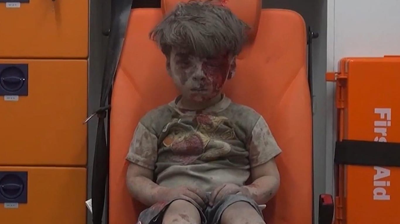 Verletzter Junge in Aleppo (Screenshot).