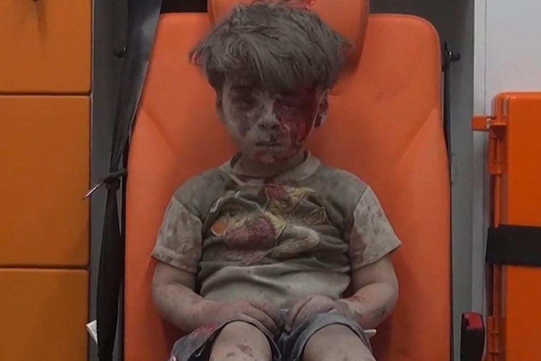 Verletzter Junge in Aleppo (Screenshot).