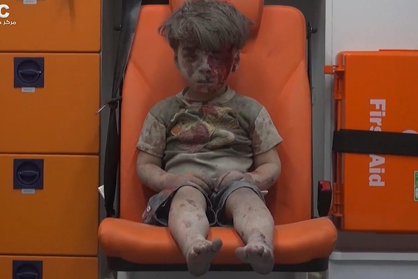 Das Foto des kleinen Omran Daqneesh ging um die Welt.