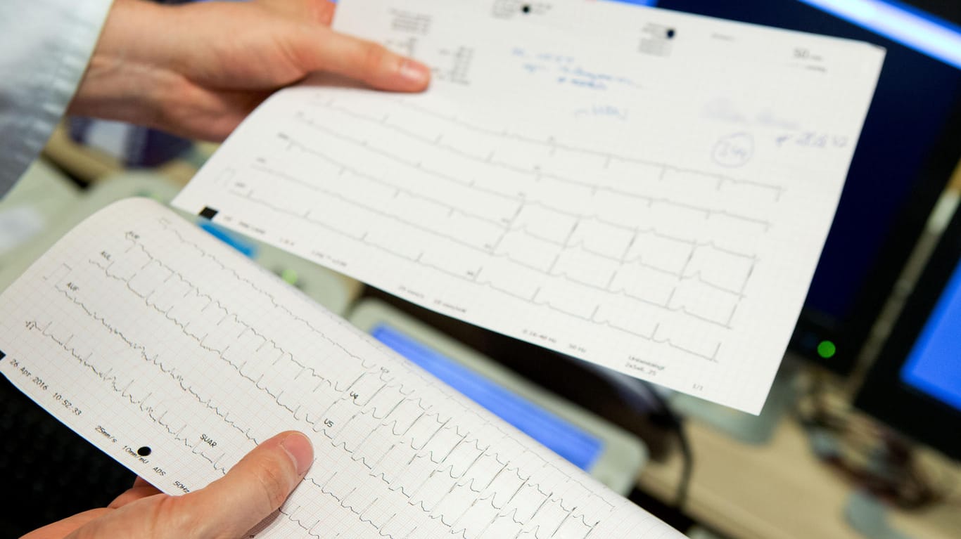 Ein EKG gibt Aufschluss über Unregelmäßigkeiten im Herzschlag.