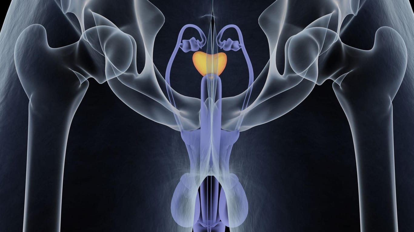 Problemzone Prostata: Ältere Männer haben häufig einen Tumor in dem Organ.