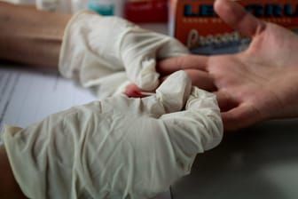 Hepatitis C wird mit einem Bluttest nachgewiesen.