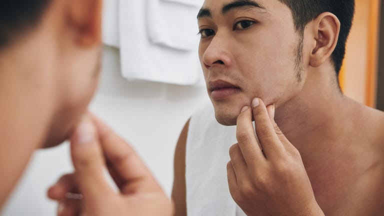 Gerade bei asiatischen Männern ist der Bartwuchs oft spärlich, in Europa haben jedoch auch viele Männer mit diesem Problem zu kämpfen.