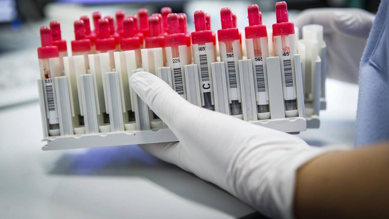 HIV-Test: Blutproben im Labor.