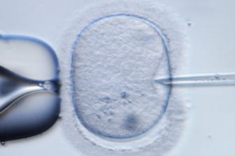 Menschliche Eizelle, in die ein Spermium injiziert wird.