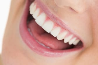 Gegen gelbe Zähne hilft aufhellende Zahnpasta nicht, sie verstärkt nur den Wiederverfärbungseffekt.