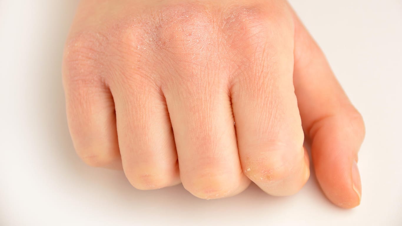 Trockene Haut: Hände werden oft durch falsche Reinigung trocken.
