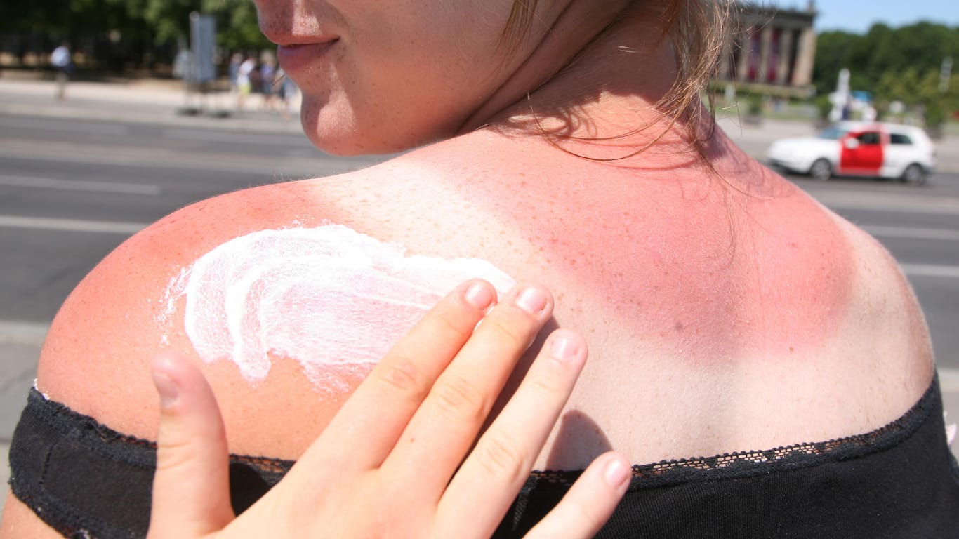Eine Frau bekommt den Rücken mit Sonnencreme eingecremt: Bei zu alten Produkten ist Vorsicht angesagt.