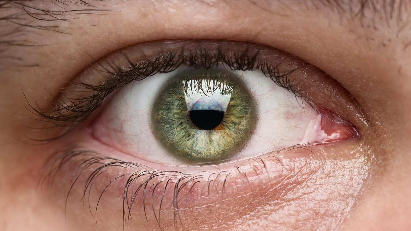 Geschädigte Blutgefäße im Auge: Hypertonie ist an den Augen erkennbar.