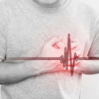 Ein unregelmäßiger Herzschlag und Brustschmerzen: Vorhofflimmern erhöht das Risiko für einen Schlaganfall.