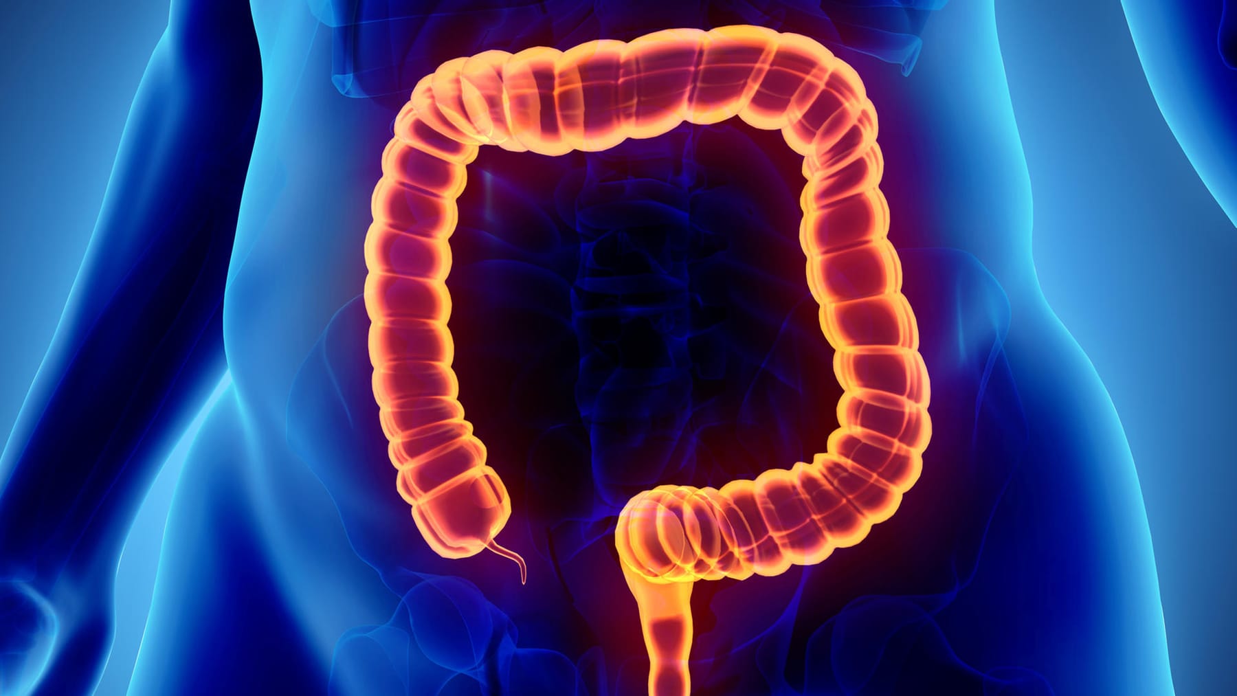 Blinddarmentzündung: Ursache, Symptome und Behandlung einer Appendizitis