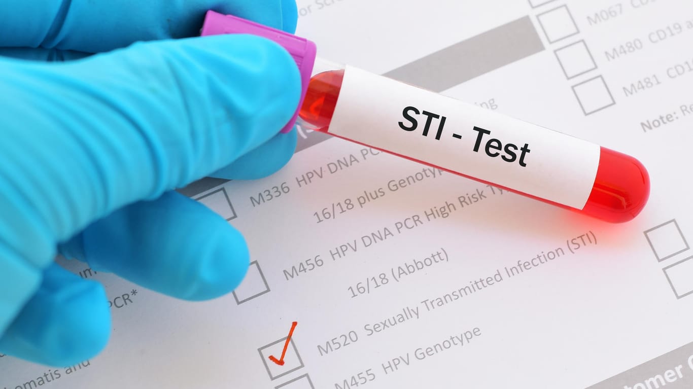 STI-Test: Chlamydien gehören zu den sexuell übertragbaren Infektionen (STI).