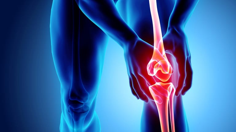 Schmerzen im Knie können durch Kristallablagerungen in den Gelenken verursacht werden.