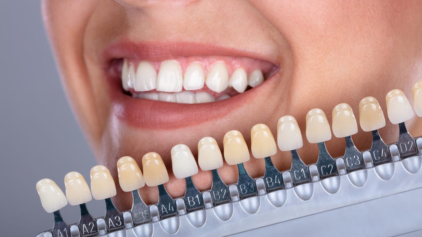 Unterschiedliche Stufen der Zahnverfärbung: Eine regelmäßige Zahnpflege beugt Karies und Verfärbungen vor. Hausmittel können bei bereits entstandenen Verfärbungen helfen.