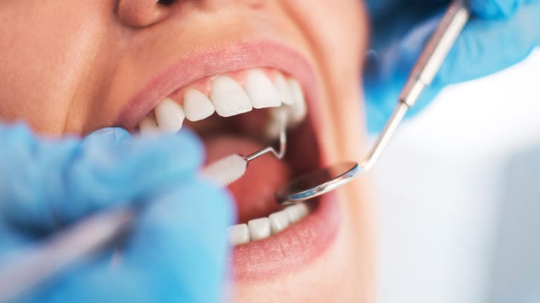Zahnarztbesuch: Eine regelmäßige Kontrolle ist wichtig.