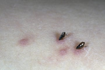 Insektenstich Welches Insekt hat mich gestochen?