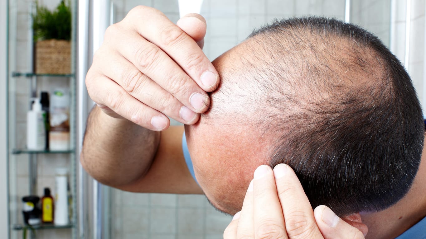 Haarausfall: Etwa jeder zweite 50-Jährige Mann ist davon betroffen.