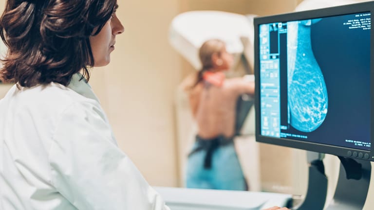 Patientin und Ärztin bei einer Mammographie: Bildgebende Untersuchungen spielen für die Diagnose von Brustkrebs eine wichtige Rolle.