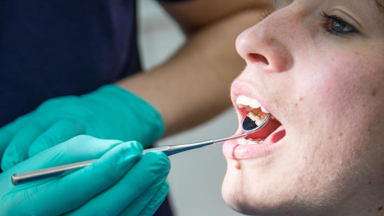 Parodontitis: Die Entzündung des Zahnbetts kann auf lange Sicht zum Verlust von Zähnen führen.