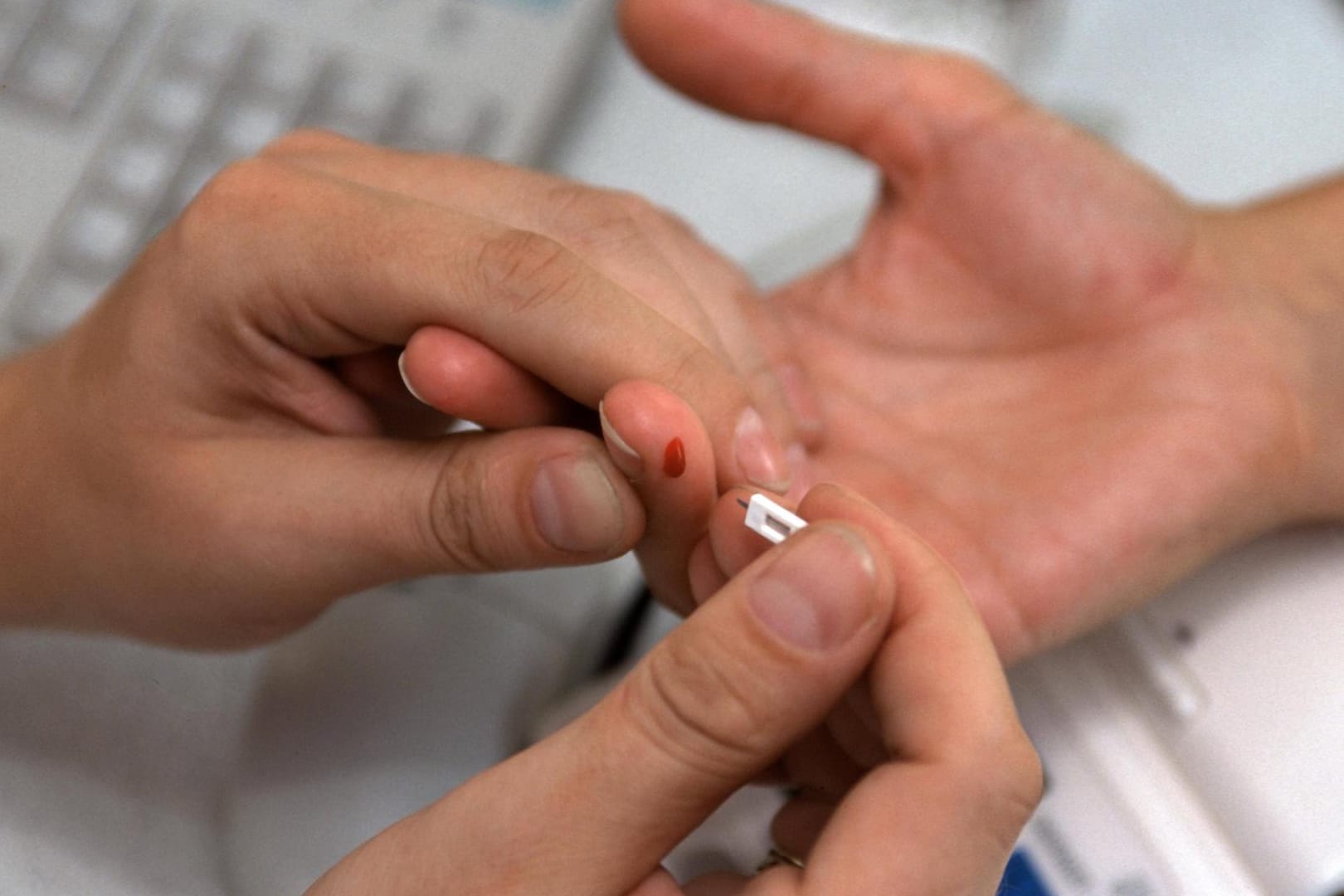 Cholesterin und Glucose-Test (Symbolbild): Je höher der LDL- oder Gesamtcholesterinwert im Blut ist, desto höher ist das Risiko für Erkrankungen des Herz-Kreislaufsystems.