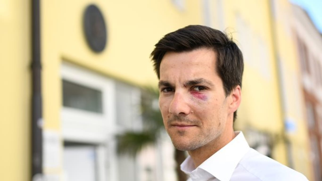 Freiburgs frische gewähltem Oberbürgermeister Martin Horn war bei seiner Wahlparty mit voller Wucht ins Gesicht geschlagen worden.