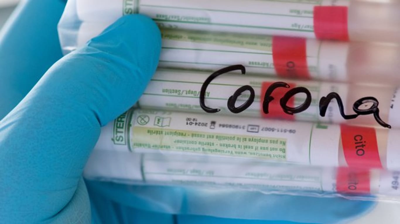 Proben für Corona-Tests werden in einem Labor vorbereitet.
