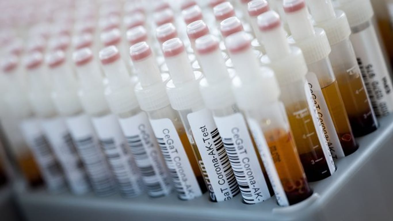 Corona-Antikörper-Tests haben an Schulen und Sachsen keine Infektionen gezeigt.