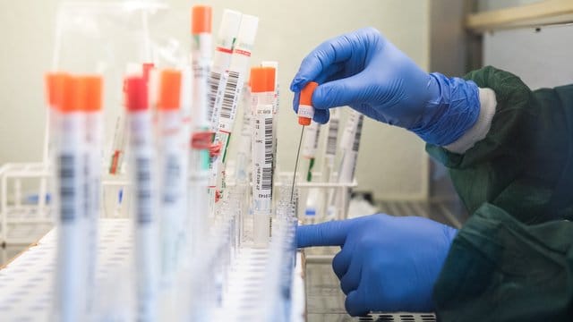 Eine Mitarbeiterin eines Labors überführt einen trockenen Abstrich eines molekularbiologischen Tests auf das SARS-CoV-2-Virus in eine Flüssigkeit. Eine Mitarbeiterin eines Labors überführt einen trockenen Abstrich eines molekularbiologischen Tests auf das SARS-CoV-2-Virus in eine Flüssigkeit.