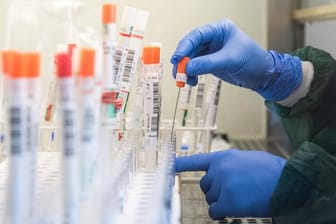 Eine Mitarbeiterin eines Labors überführt einen trockenen Abstrich eines molekularbiologischen Tests auf das SARS-CoV-2-Virus in eine Flüssigkeit.