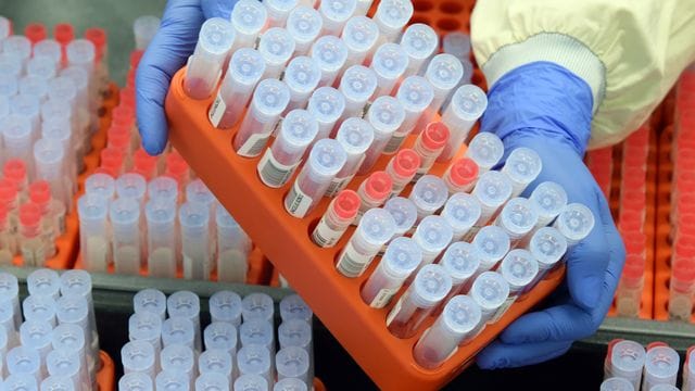 Die Leiterin der PCR-Abteilung entnimmt SARS-CoV-2-Proben aus dem Archiv für Kontrollmessungen. Die Leiterin der PCR-Abteilung entnimmt SARS-CoV-2-Proben aus dem Archiv für Kontrollmessungen.