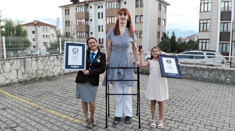 Rumeysa Gelgi: Mit 2,15 Meter wurde die Türkin zur größten Frau der Welt in das Guinness Buch der Rekorde eingetragen.