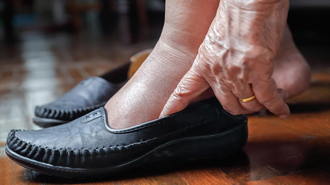 Eine ältere Frau mit geschwollen Füßen zieht sich einen Schuh an. Diabetiker sollten achtsam mit ihren Füßen umgehen und schon bei kleinen Veränderungen einen Arzt aufsuchen.