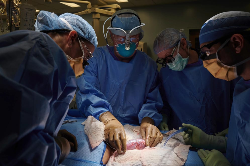 Transplantation: Auf diesem Foto vom September 2021, das von NYU Langone Health zur Verfügung gestellt wurde, untersucht ein Chirurgenteam in einem Krankenhaus eine Schweineniere.