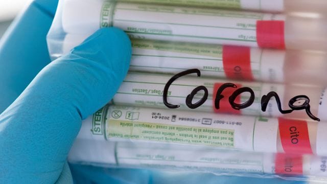 Proben für Corona-Tests