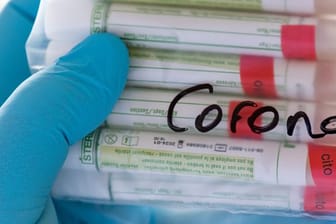 Proben für Corona-Tests