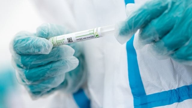 Ein medizinischer Mitarbeiter hält ein Teströhrchen in den Händen Ein medizinischer Mitarbeiter hält ein Teströhrchen in den Händen