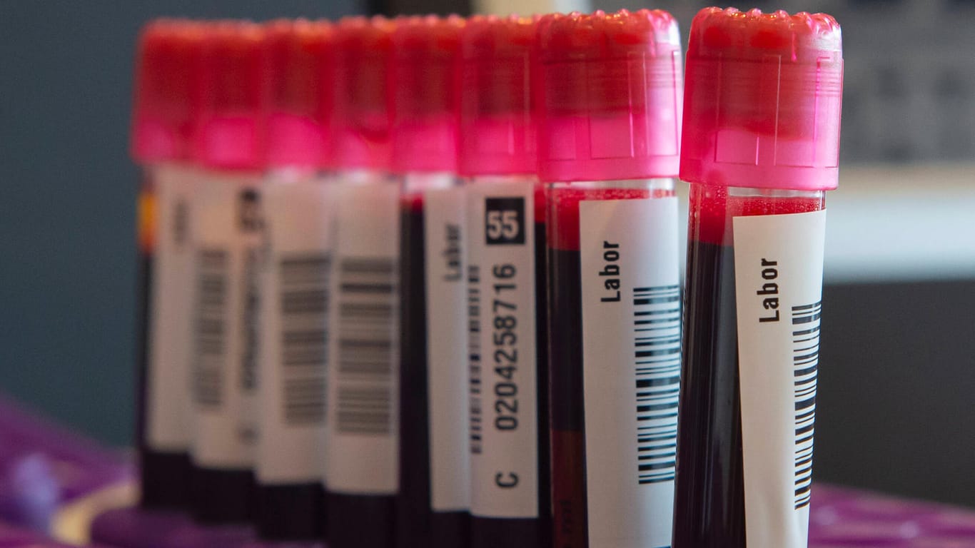 Röhrchen mit Blut: Gegen eine Ex-Krankenpflegerin aus Halle wird ermittelt, weil sie Blutproben manipuliert haben soll. (Symbolbild)