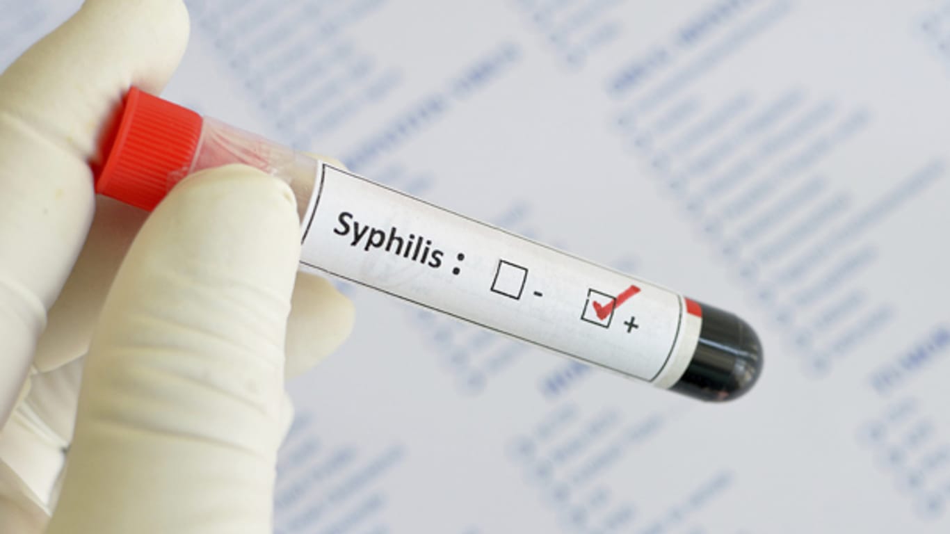 Mithilfe einer Blutuntersuchung kann eine Syphilis festgestellt werden