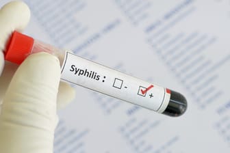 Mithilfe einer Blutuntersuchung kann eine Syphilis festgestellt werden